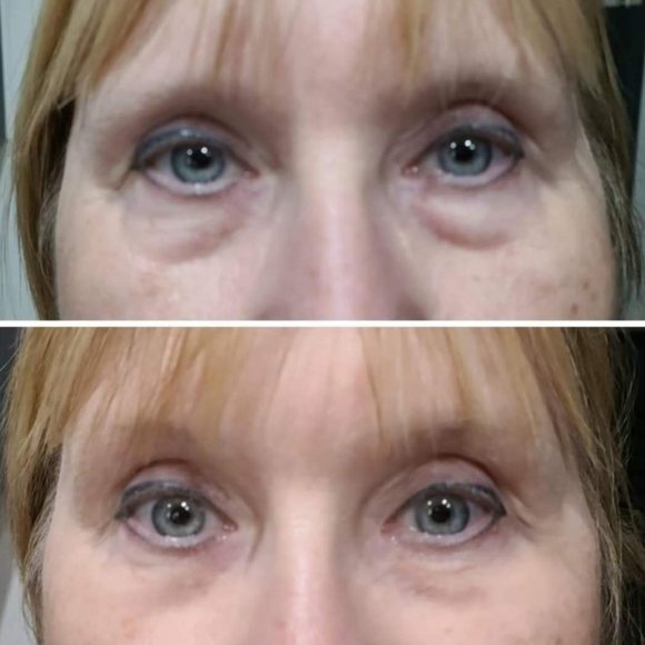 NEW! Rapid Rewind Wrinkle Reducer - Picture 8 of 16